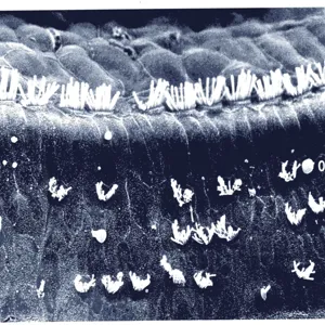 Et svart-hvitt-bilde av ødelagte hårceller. Bildet er tatt i mikroskop.