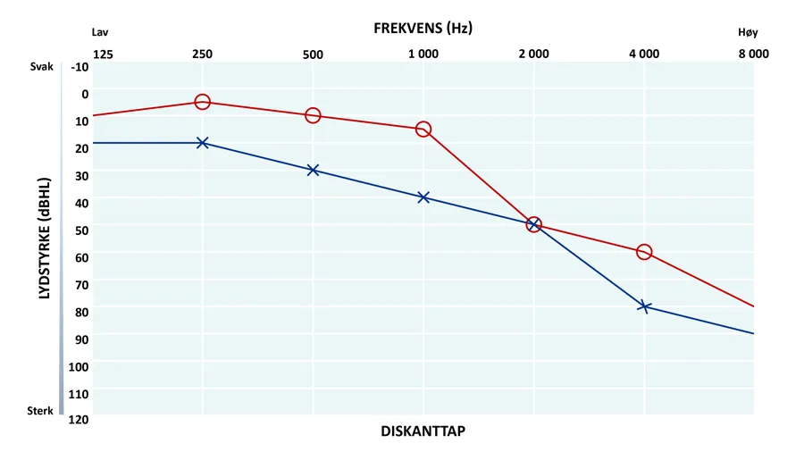 Audiogram som viser diskanttap på begge ører.