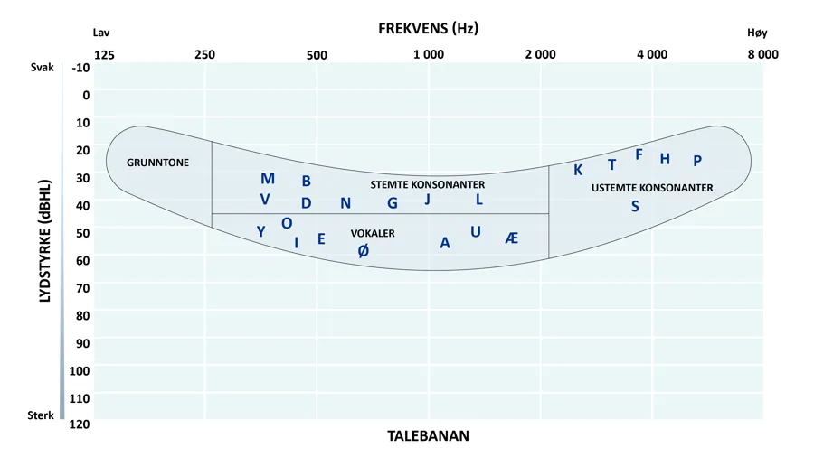 Talebanan, illustrasjon som viser talespråklyder.