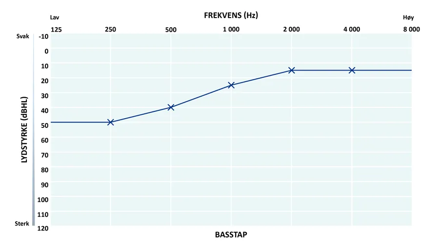 Audiogram som viser basstap.