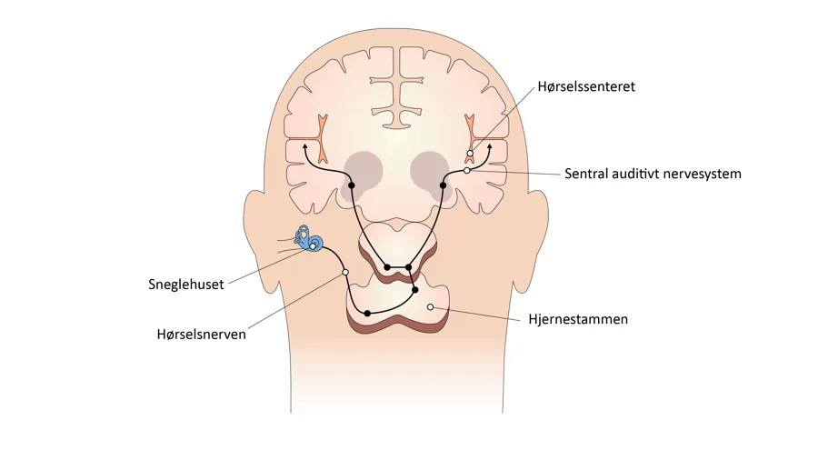 Tegning av hørselsbanene og hørselssentrene.