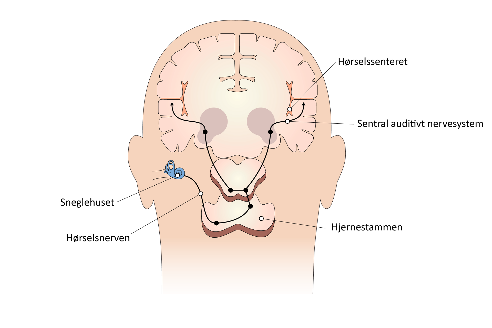 Illustrasjon av hjernen med streker og tekst som forklarer de hørselsrelaterte delene.